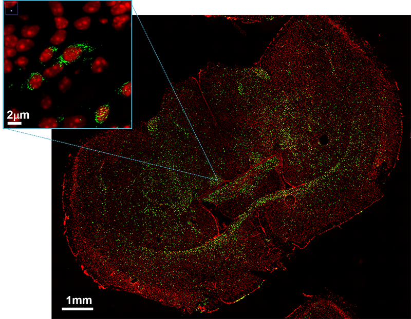 Mouse Brain
Plp1 mRNA labeled with Stellaris RNA FISH probes DAPI and imaged with Stellarvision